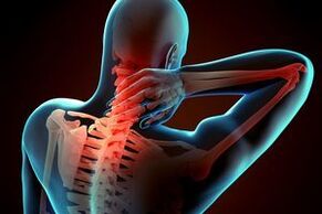 Cervical osteochondrosis