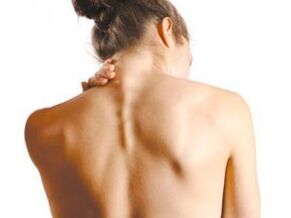Neck pain due to osteochondrosis